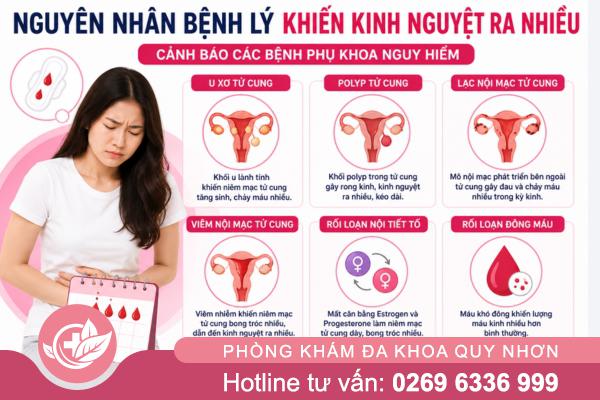 Kinh Nguyệt Ra Nhiều Kéo Dài Có Nguy Hiểm Không? Cảnh Báo Các Bệnh Phụ Khoa Cần Lưu Ý
